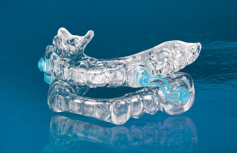 Sleep Apnea Appliance – Orthodontia AE